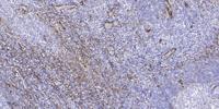 ACBD6 Polyclonal Antibody