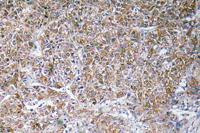 ACBP Polyclonal Antibody
