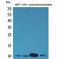 ACBP Polyclonal Antibody