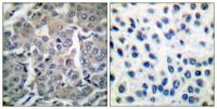 ACCα Polyclonal Antibody
