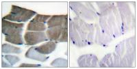 ACCα Polyclonal Antibody