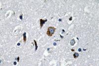 ACE1 Polyclonal Antibody
