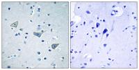 GPR158 Polyclonal Antibody