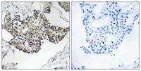 RSAD1 Polyclonal Antibody