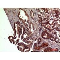 RSAD2 Polyclonal Antibody