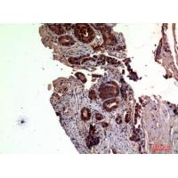 RSAD2 Polyclonal Antibody