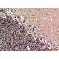 RSAD2 Polyclonal Antibody