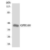 GPR160 Polyclonal Antibody