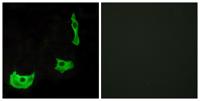 GPR17 Polyclonal Antibody