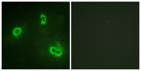 Rsk-1 Polyclonal Antibody