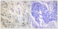 Rsk-1 Polyclonal Antibody