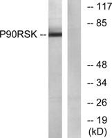 Rsk-1 Polyclonal Antibody