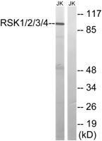 Rsk-1/2/3/4 Polyclonal Antibody