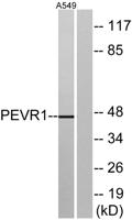 GPR172A Polyclonal Antibody