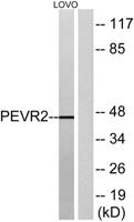 GPR172B Polyclonal Antibody