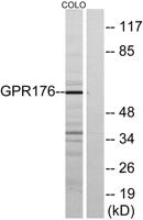 GPR176 Polyclonal Antibody