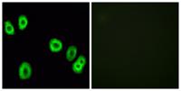 GPR18 Polyclonal Antibody