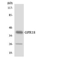 GPR18 Polyclonal Antibody