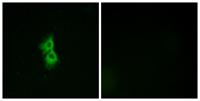 GPR22 Polyclonal Antibody