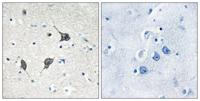 GPR20 Polyclonal Antibody