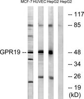 GPR19 Polyclonal Antibody