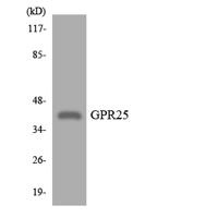 GPR25 Polyclonal Antibody