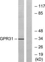 GPR31 Polyclonal Antibody