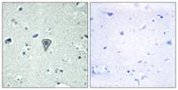 GPR37L1 Polyclonal Antibody