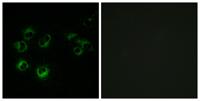 GPR42 Polyclonal Antibody
