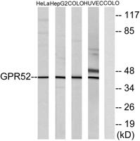 GPR52 Polyclonal Antibody