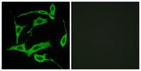 GPR85 Polyclonal Antibody
