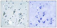 GPR85 Polyclonal Antibody
