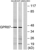 GPR87 Polyclonal Antibody