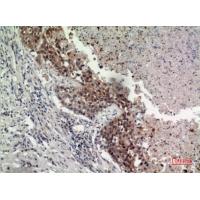 GPR87/95 Polyclonal Antibody