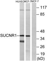 GPR91 Polyclonal Antibody