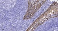 GPR98 Polyclonal Antibody