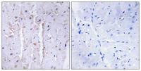 AKAP 13 Polyclonal Antibody