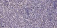 SACS Polyclonal Antibody