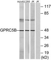GPRC5B Polyclonal Antibody