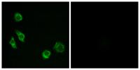 GPRC5D Polyclonal Antibody
