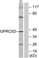 GPRC5D Polyclonal Antibody