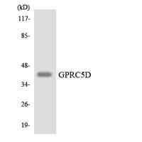GPRC5D Polyclonal Antibody