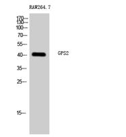 GPS2 Polyclonal Antibody