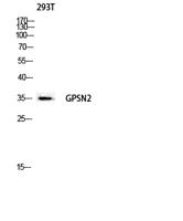 GPSN2 Polyclonal Antibody