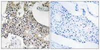 GPSN2 Polyclonal Antibody