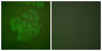 GR Polyclonal Antibody