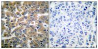 GR Polyclonal Antibody