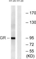 GR Polyclonal Antibody
