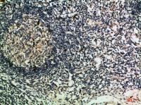 Granzyme M Polyclonal Antibody