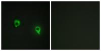AKAP 149 Polyclonal Antibody